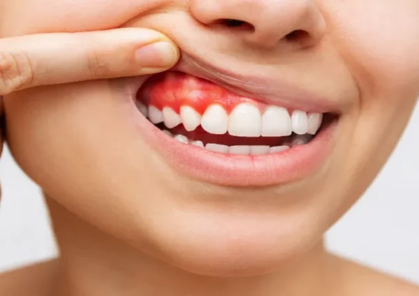 periodontoloji-dis-eti-hastaliklari